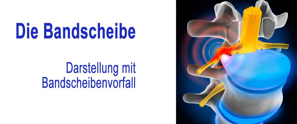 Fitnessstudio Dresden Perfect Body - Der Bandscheibenvorfall