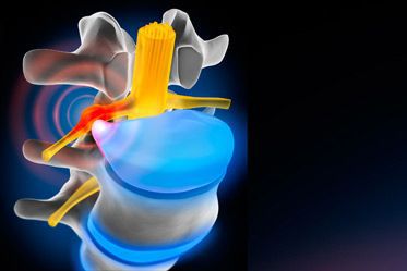 Fitnessstudio Dresden Perfect Body - Die Bandscheibe