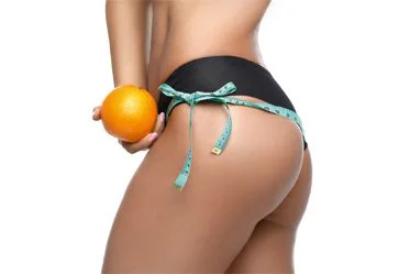 Fitnessstudio Dresden Perfect Body - Slimyonik und Cellulite